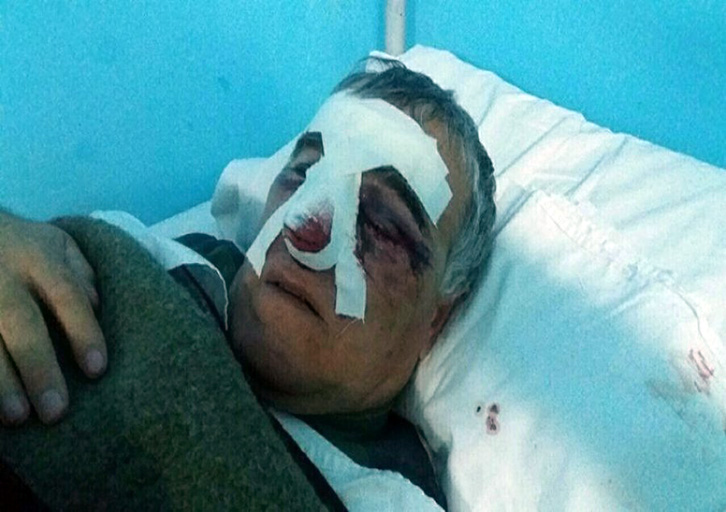 Korçë, i theu hundën shokut pse i qerasi gruan, pezullohet polici