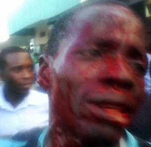 Prostituta gjakos klientin, zhgënjehet nga “pagesa” e tij