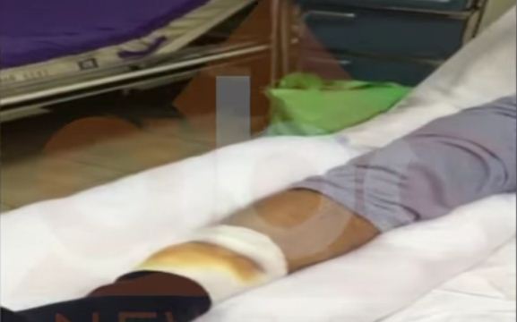 VIDEO/Policia fshehu viktimën e dytë të deputetit Armando Prenga