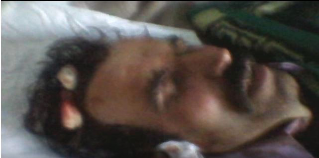 FOTO/ Përfundon me vesh të prerë sherri për në vijë uji mes djemve të xhaxhallarëve