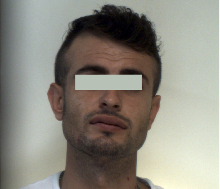 EMRI & FOTO GALERI/ Itali, shqiptari tradhton veten, i gjejnë drogën në çantë