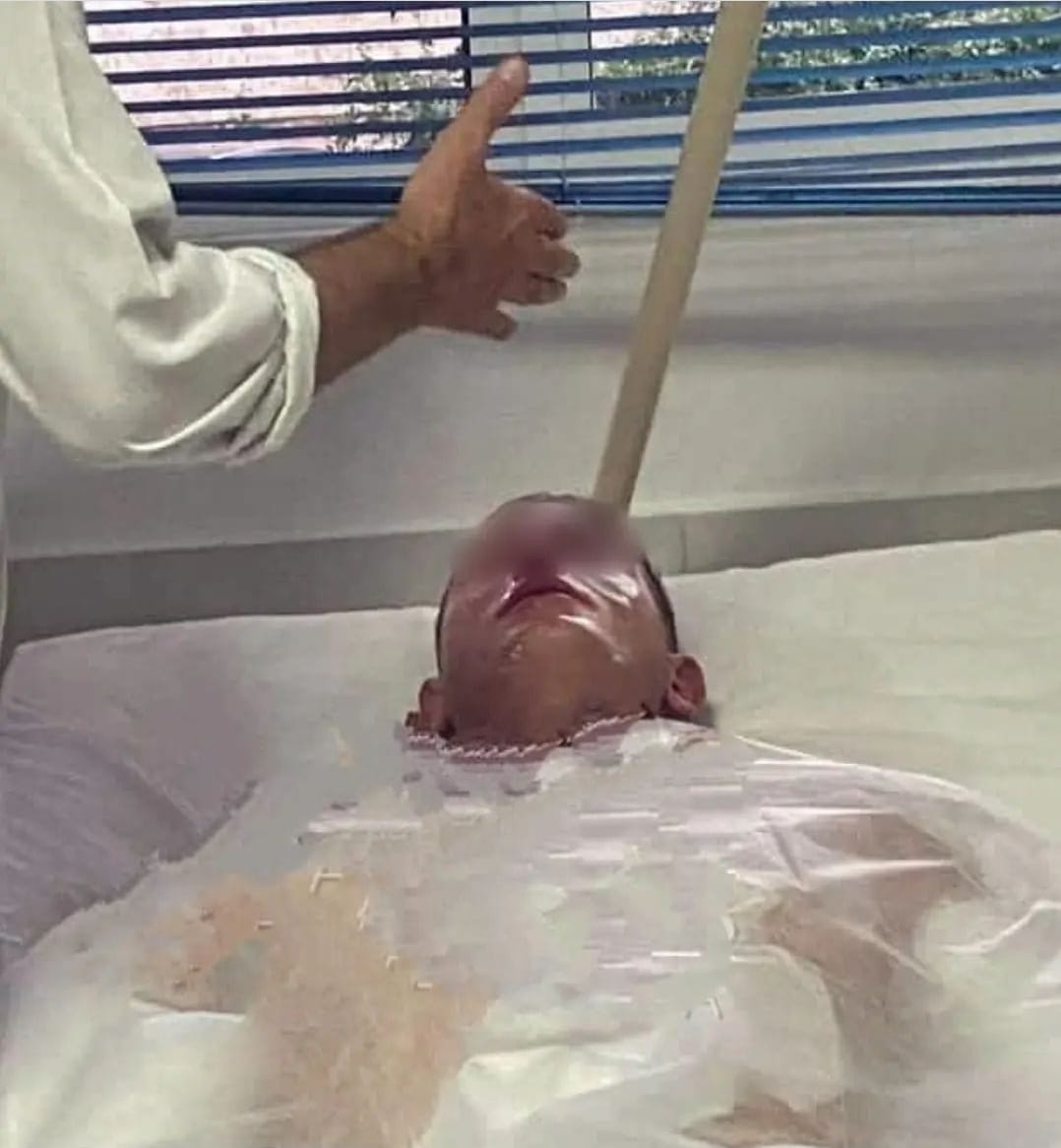 FOTOT/ Mësohen emrat, kush janë dy ushtarakët që u sulmuan nga rusët në Gramsh