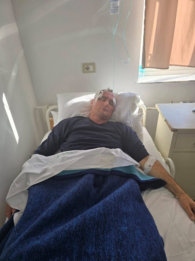 FIER/ Sulmohet babai dhe i biri në shtëpi, personat ishin me armë