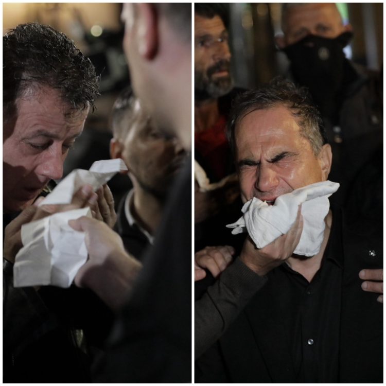 Dhunë e policisë në protestë, deputetët Flamur Noka dhe Luçiano Boçi goditen. Boçi në spital, Noka mjekohet në rrugë