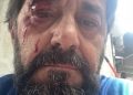 Goditet me grusht gazetari Ilir Demaliaj në Tiranë, autori shpallet në kërkim