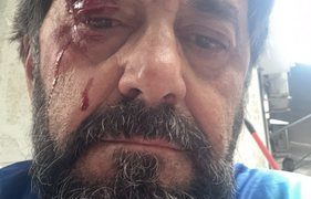 Goditet me grusht Ilir Demaliaj në Tiranë, autori shpallet në kërkim