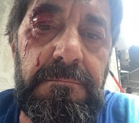 Goditet me grusht gazetari Ilir Demaliaj në Tiranë, autori shpallet në kërkim