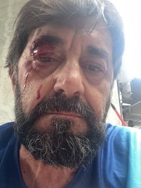 Goditet me grusht Ilir Demaliaj në Tiranë, autori shpallet në kërkim