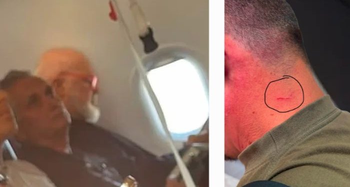 “Të zhduk”! Rama e gërvish me thonj dhe e dorëzon tek policia pas zbritjes nga avioni
